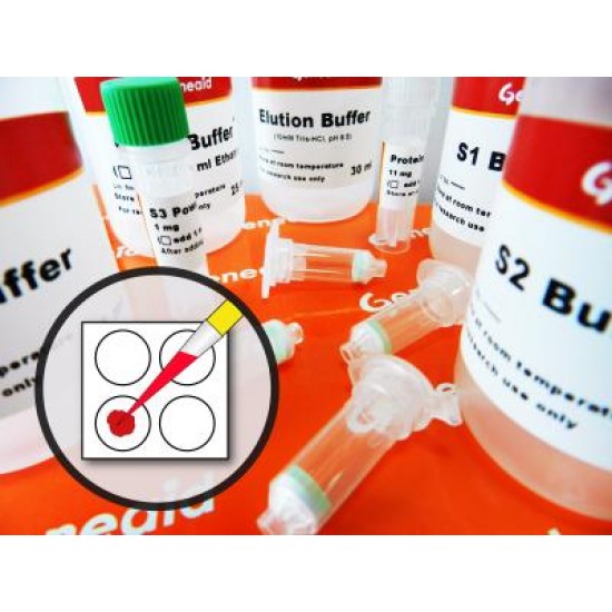 Dry Blood Spot DNA Kit (100 rxns) Dry Blood Spot DNA Kit (100 rxns)