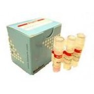 Fast Plus EvaGreen® qPCR master mix (100 rxns)