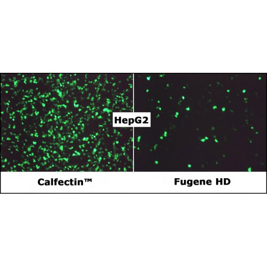 GenJet™ In Vitro DNA Transfection Reagent (1.0 ml)