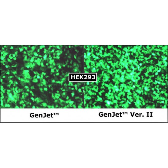 GenJet™ In Vitro DNA Transfection Reagent (Ver. II) (1.0 ml)