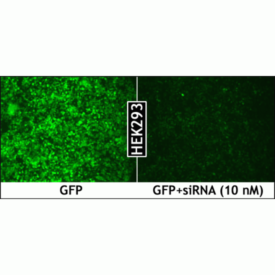 LipoJet™ In Vitro Transfection Kit (Ver. II) (1.0 ml)