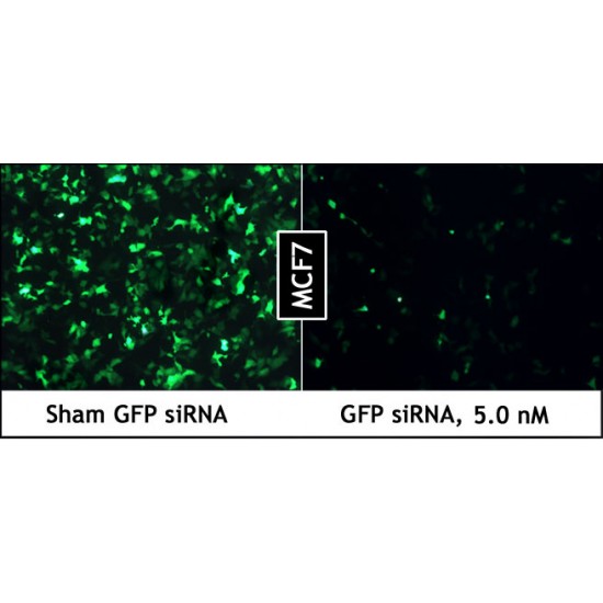 PepMute™ siRNA Transfection Reagent (1.0 ml)